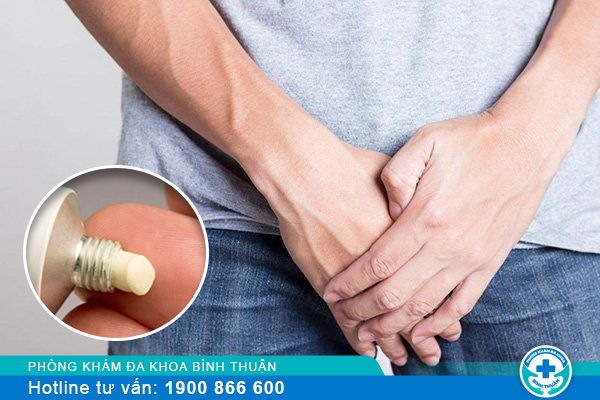 Có thuốc bôi viêm bao quy đầu hiệu quả không?